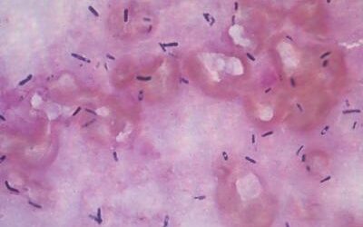 Bacterias que son todo ojos