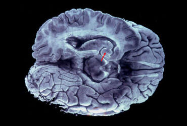 Crean una réplica en tercera dimensión del cerebro humano