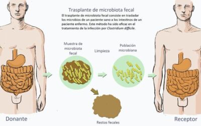 Una nueva técnica mejora la eficacia del trasplante de microbiota fecal intestinal