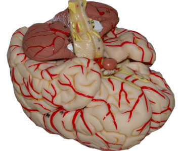 Cerebro con arterias (CER-ART)