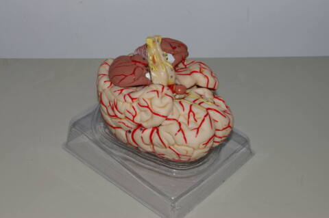 Cerebro con arterias (CER-ART) - Imagen 2