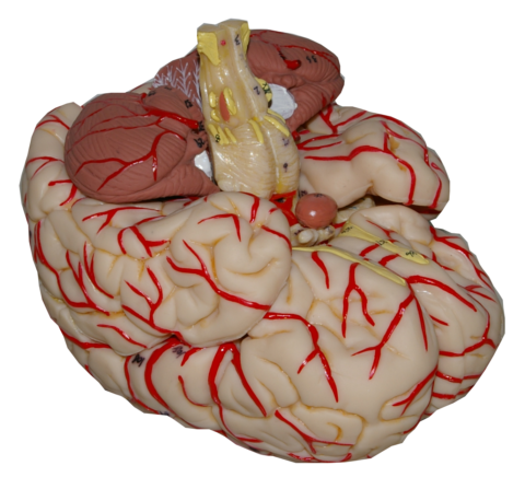 Cerebro con arterias (CER-ART)