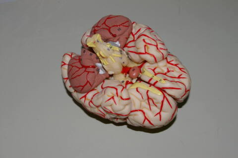 Cerebro con arterias (CER-ART) - Imagen 3