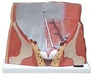 Pelvis masculina sección inguinal