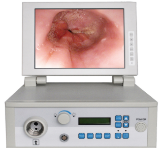 PROCESADOR DE IMAGEN PARA ENDOSCOPÍA CON MONITOR DE VIDEO. MODELO: VIS2100S