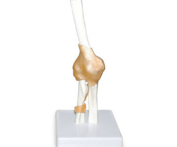MODELO DE ARTICULACIÓN DE CODO
