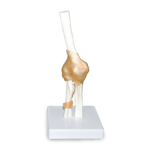MODELO DE ARTICULACIÓN DE CODO