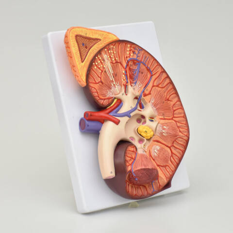 RIÑÓN CON GLÁNDULA RENAL, 3 VECES SU TAMAÑO - Imagen 2