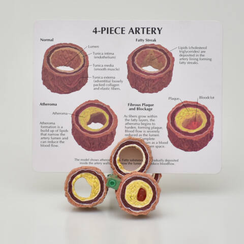 ARTERIA - Imagen 3