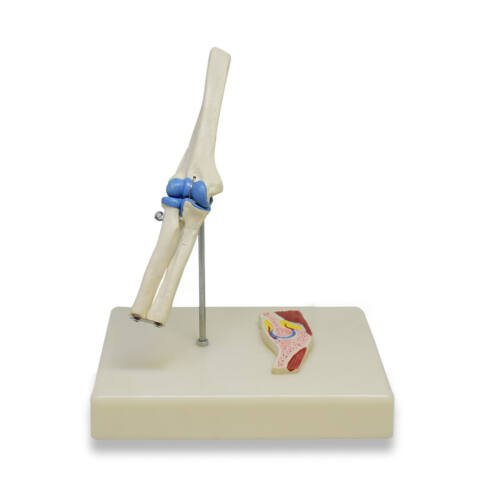 ARTICULACIÓN DE CODO