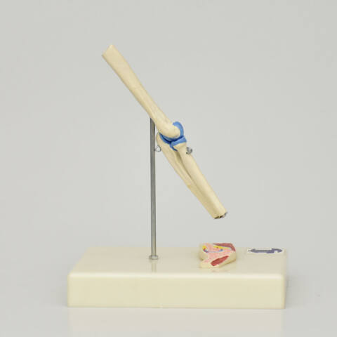 ARTICULACIÓN DE CODO - Imagen 2