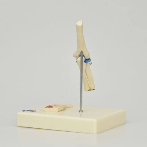 ARTICULACIÓN DE CODO - Imagen 3