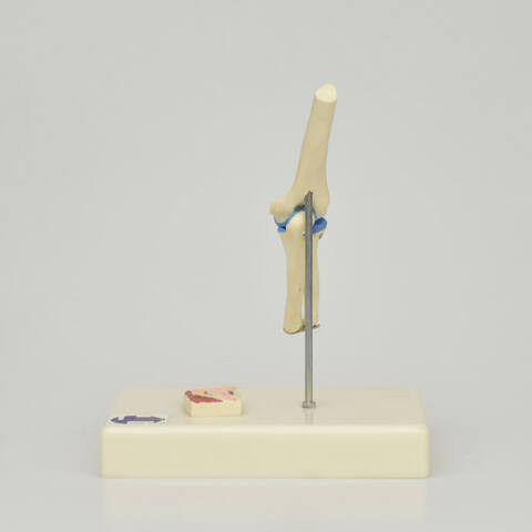 ARTICULACIÓN DE CODO - Imagen 4