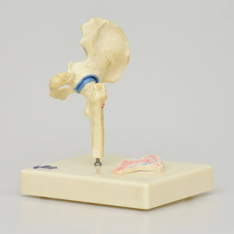 ARTICULACIÓN DE CADERA - Imagen 3