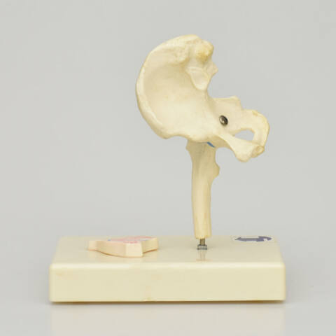 ARTICULACIÓN DE CADERA - Imagen 2