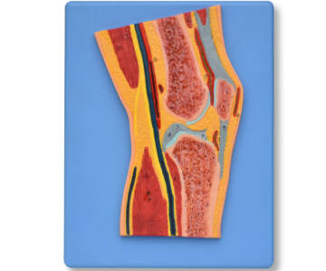 MODELO SECCIONADO DE ARTICULACIÓN DE RODILLA