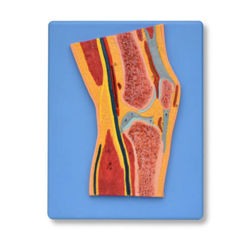 MODELO SECCIONADO DE ARTICULACIÓN DE RODILLA