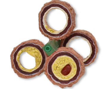 ARTERIA