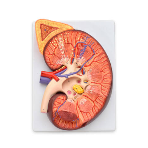 RIÑÓN CON GLÁNDULA RENAL, 3 VECES SU TAMAÑO