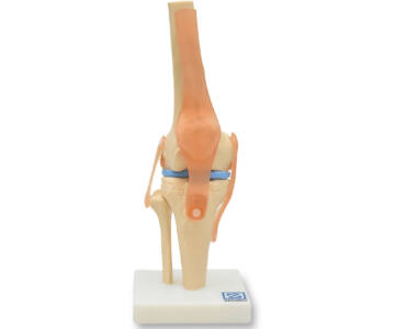ARTICULACIÓN DE RODILLA