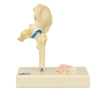 ARTICULACIÓN DE CADERA