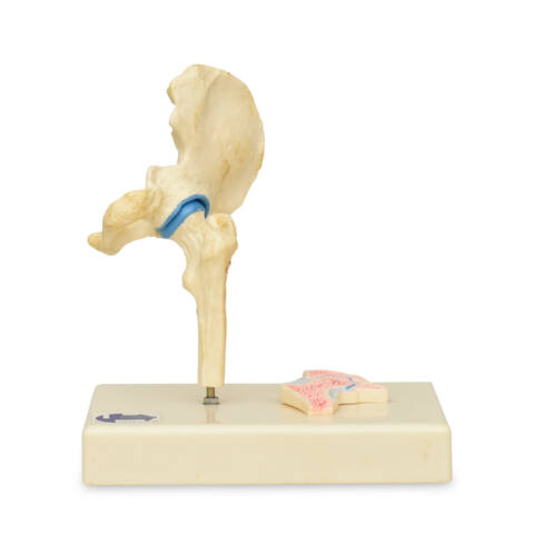 ARTICULACIÓN DE CADERA