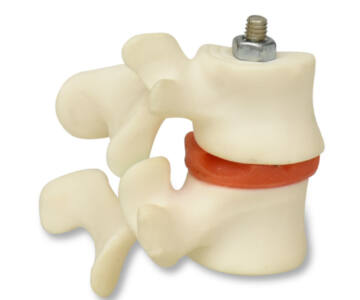 MODELO ANATÓMICO DE OSTEOPOROSIS, 2 VÉRTEBRAS