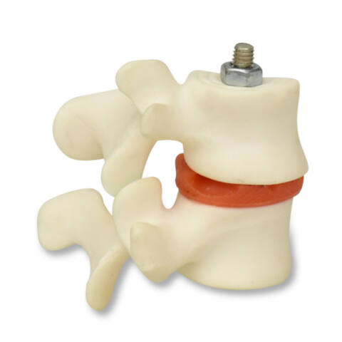 MODELO ANATÓMICO DE OSTEOPOROSIS, 2 VÉRTEBRAS