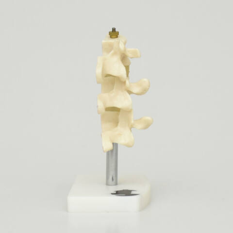 MODELO DE OSTEOPOROSIS, 3 VÉRTEBRAS CON BASE - Imagen 3