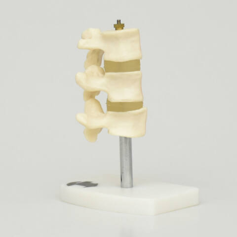 MODELO DE OSTEOPOROSIS, 3 VÉRTEBRAS CON BASE - Imagen 2
