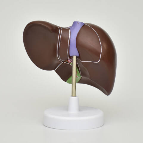 HIGADO CON VESICULA BILIAR - Imagen 2