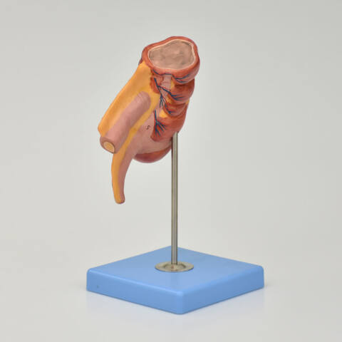 APENDICE E INTESTINO CIEGO - Imagen 3