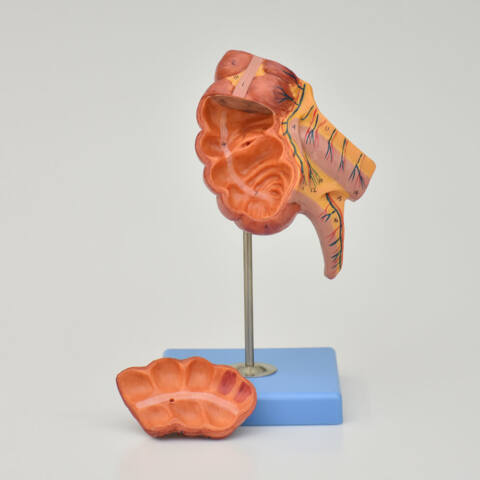 APENDICE E INTESTINO CIEGO - Imagen 4