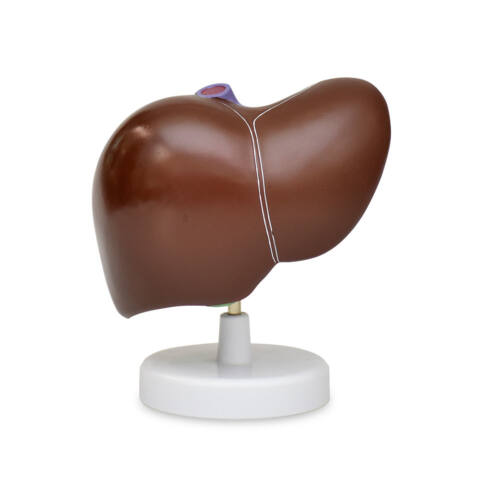 HIGADO CON VESICULA BILIAR