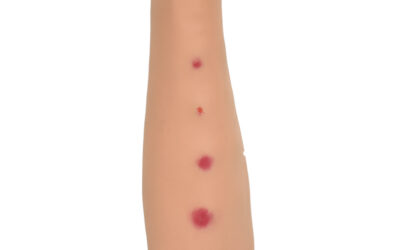 Brazo de entrenamiento para inyección intradérmica