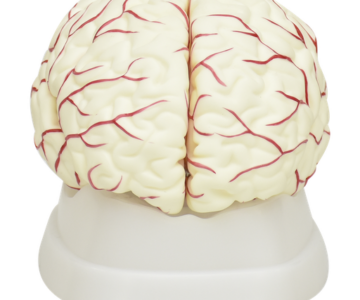 Cerebro blanco con arterias
